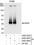 Detection of human NPM1 by western blot of immunoprecipitates.