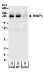 Detection of human RRBP1 by western blot.