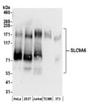 Detection of human and mouse SLC9A6 by western blot.