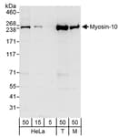 Detection of human and mouse Myosin-10 by western blot.