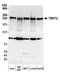 Detection of human TRIP12 by western blot.