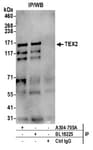 Detection of human TEX2 by western blot of immunoprecipitates.