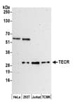 Detection of human and mouse TECR by western blot.