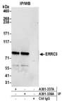 Detection of human ERRC3 by western blot of immunoprecipitates.