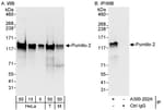 Detection of human and mouse Pumilio 2 by western blot (h&amp;m) and immunoprecipitation (h).