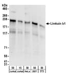 Detection of human and mouse Limkain b1 by western blot.