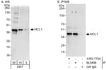 Detection of human MCL1 by western blot and immunoprecipitation.
