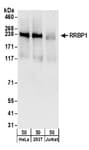 Detection of human RRBP1 by western blot.