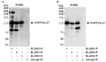 Detection of human HURP/DLG7 by western blot of immunoprecipitates.