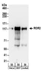 Detection of human ROR2 by western blot.