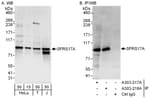 Detection of human SFRS17A by western blot and immunoprecipitation.
