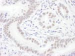 Detection of human Sm-D3 by immunohistochemistry.