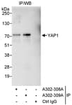 Detection of human YAP1 by western blot of immunoprecipitates.