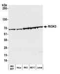 Detection of human RIOK3 by western blot.