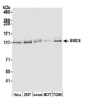 Detection of human and mouse SMC6 by western blot.