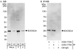 Detection of human EXOSC4 by western blot and immunoprecipitation.