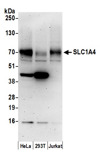 Detection of human SLC1A4 by western blot.
