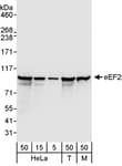 Detection of human and mouse eEF2 by western blot.