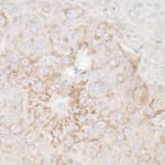 Detection of mouse ATP5A1 by immunohistochemistry.