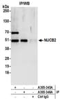 Detection of human NUCB2 by western blot of immunoprecipitates.