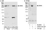 Detection of human and mouse DRIM by western blot (h&amp;m) and immunoprecipitation (h).