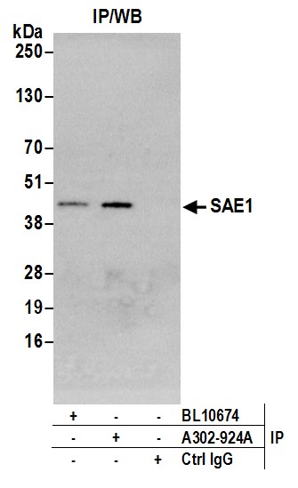 Anti Sae1 Erklärung | A Case of Anti-SAE1 Dermatomyositis – REJBZ