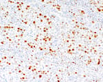Detection of human Topo II Alpha by immunohistochemistry.