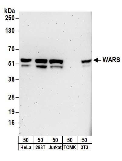 Detection of human and mouse WARS by western blot.