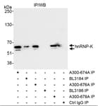 Detection of human hnRNP-K by western blot of immunoprecipitates.