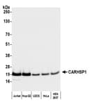 Detection of human CARHSP1 by western blot.