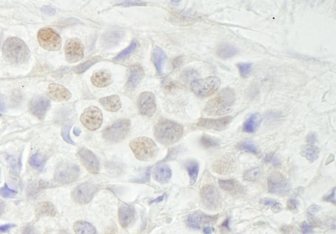 Rabbit anti-BCAS3 IHC Antibody