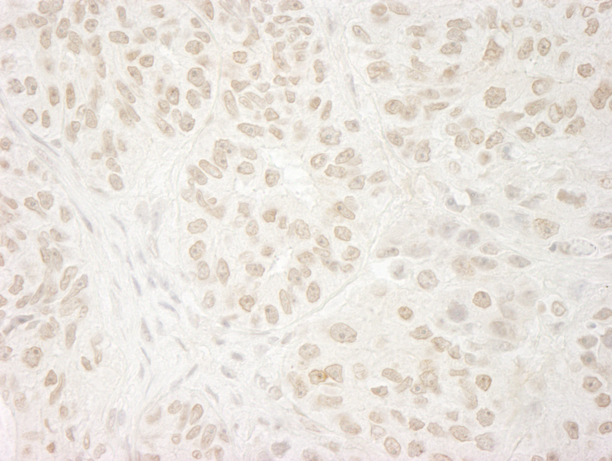 Rabbit anti-USP37 IHC Antibody