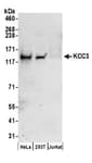 Detection of human KCC3 by western blot.