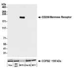 Detection of human CD206/Mannose Receptor by western blot.