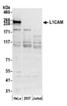 Detection of human L1CAM by western blot.