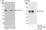 Detection of human FOXN3 by western blot and immunoprecipitation.