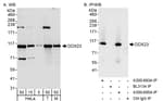 Detection of human and mouse DDX23 by western blot (h&amp;m) and immunoprecipitation (h).