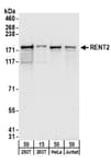 Detection of human RENT2 by western blot.