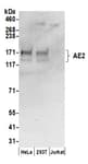 Detection of human AE2 by western blot.