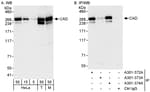 Detection of human and mouse CAD by western blot (h&amp;m) and immunoprecipitation (h).