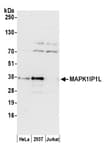 Detection of human MAPK1IP1L by western blot.