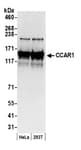 Detection of human CCAR1 by western blot.