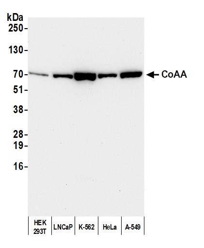 Detection of human CoAA by western blot.