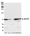 Detection of human and mouse HEATR3 by western blot.