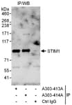 Detection of human STIM1 by western blot of immunoprecipitates.