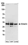Detection of human Emerin by western blot.
