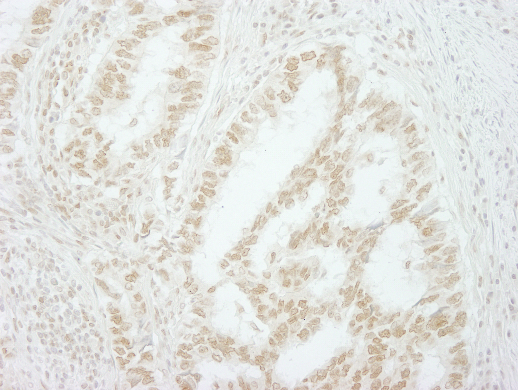 Rabbit anti-MKRN2 IHC Antibody