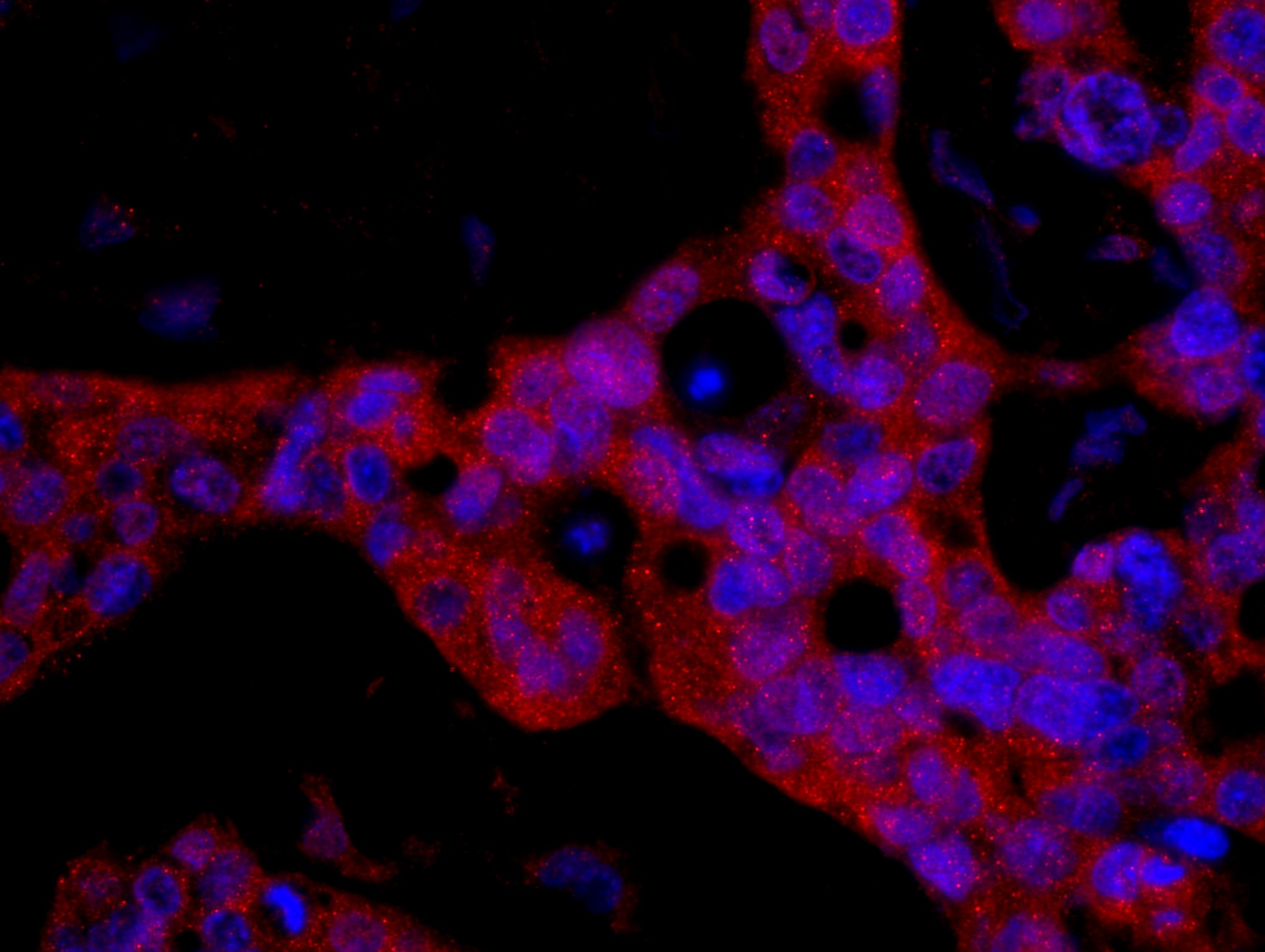 Detection of human FKBP4/FKBP52 by immunohistochemistry.