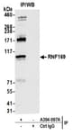 Detection of human RNF169 by western blot of immunoprecipitates.