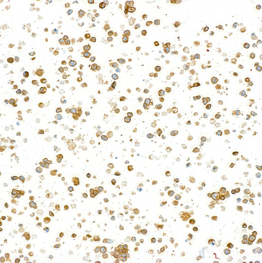 Detection of mouse CD79B by immunocytochemistry.